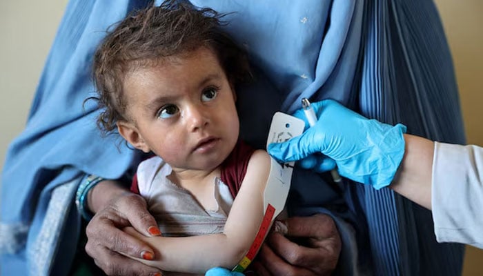 An Afghan girl looks at the doctor as he measures her upper arm at the WFP-supported Qasaba Clinic, after an increase in malnutrition cases following the return of deported Afghans, in Kabul, Afghanistan, January 7, 2026.—Reuters