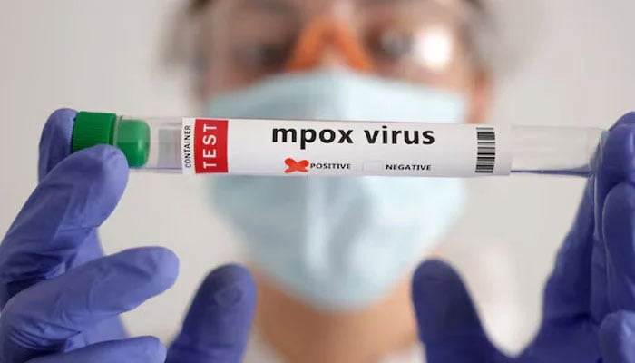 A test tube labelled Mpox virus positive is held in this illustration taken August 20, 2024. — Reuters
