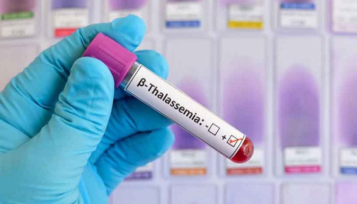 The representational image shows a blood sample in a test tube used for beta thalassemia screening. — The News/File