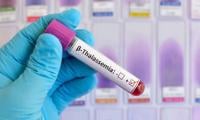Anti-thalassemia Efforts Linked To Awareness Raising