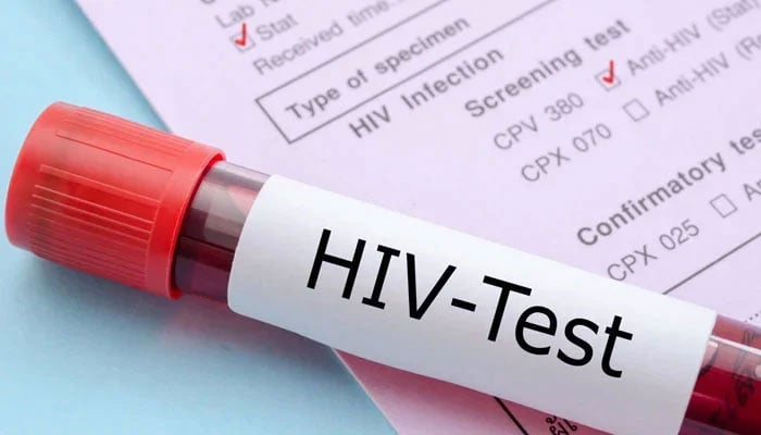 The image displays a blood sample tube labeled HIV-Test resting on a medical requisition form, indicating a laboratory test for HIV infection. — The News/File