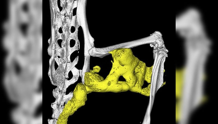 Abnormal bone formation in soft tissue, a process known as heterotopic ossification, in the hindlimb region of a mouse model of fibrodysplasia ossificans progressiva is shown in this image released to Reuters on September 2, 2015. — Reuters