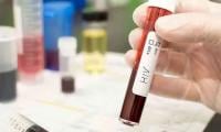 Another HIV Outbreak?: 26 Children, Two Healthcare Workers Test Positive For HIV In Khairpur