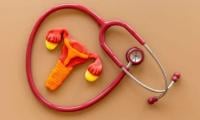 Polycystic Ovary Syndrome Renamed ‘PMOS’ After Global Consensus