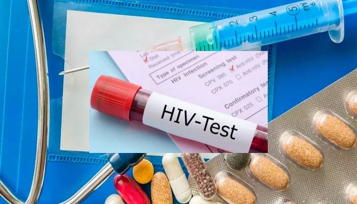 The image displays a blood sample tube labeled HIV-Test resting on a medical requisition form, indicating a laboratory test for HIV infection. — The News/File