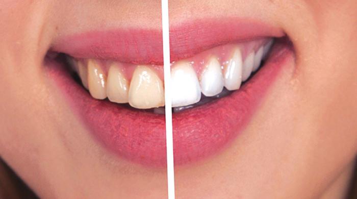 The stains we sip daily – coffee, chai and the pressure to stay white