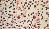 What is hantavirus, and can it spread between humans?